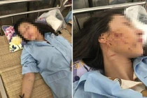 Khởi tố 3 phụ nữ đánh ghen lột đồ, đổ nước mắm, bột ớt lên nữ chủ tiệm spa