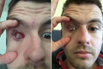 Khiếp sợ thanh niên mù cả mắt chỉ vì điều đơn giản này 