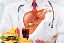 Điểm danh 5 thực phẩm không tốt cho gan