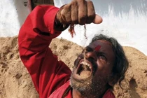 Nghiện ăn đất cát, "dị nhân" khiến người nhà khiếp đảm