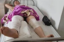 Người đàn ông vào viện chữa chân, chẳng ngờ bác sĩ nhầm hại thế này...