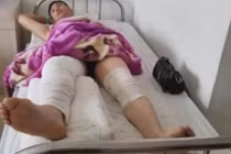 Người đàn ông vào viện chữa chân, chẳng ngờ bác sĩ nhầm hại thế này...