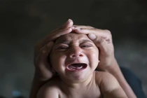 Thai phụ đầu tiên nhiễm virus Zika phải bỏ con