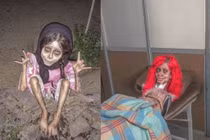 Cô gái trông hệt như xác sống và sự thực rợn người