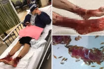 Bàn chân đẫm máu dưới biển của cậu thiếu niên và sự thật ghê rợn