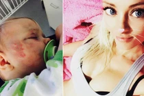 Bé gái bị bầm dập mặt mũi và sự thật về người mẹ trẻ quyến rũ