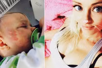 Bé gái bị bầm dập mặt mũi và sự thật về người mẹ trẻ quyến rũ