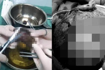 Chó hoang cắn khắp đầu mặt bé trai, 10 vết rướm máu kinh dị...