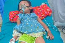 Sau 5 phút bị kiến đốt, bé 3 tuổi ở Tuyên Quang sốc phản vệ