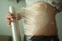 Mỡ bụng sẽ xẹp chỉ sau 1 đêm xoa bóp, massage với hỗn hợp tự chế này