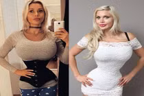 Mê eo con kiến, người phụ nữ làm điều kinh dị, đau đớn rụng rời...