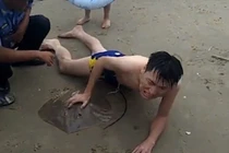 Thư giãn dưới nước, người đàn ông bị loài vật "dị" găm của quý 