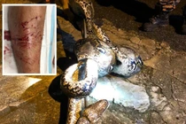 Thấy chân nặng nặng, tưởng mèo đu lên, hóa ra “quái thú” kinh hoàng