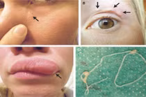 Da mặt rung động lạ thường, người phụ nữ kinh hoàng phát hiện...