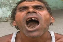 Không phải thức ăn, bùn đất và gạch vụn là “món tủ” của người này