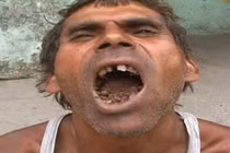 Không phải thức ăn, bùn đất và gạch vụn là “món tủ” của người này