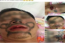 Chồng thường xuyên say xỉn, vợ trừng trị vẽ chằng chịt lên mặt 
