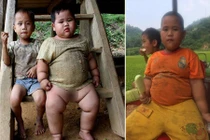 Cậu bé “Thánh Gióng” 15kg khi tròn 5 tháng bây giờ ra sao?