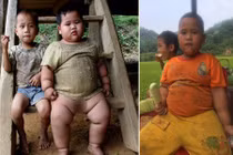 Cậu bé “Thánh Gióng” 15kg khi tròn 5 tháng bây giờ ra sao?