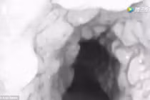 Kinh hoàng hàng loạt răng mọc trong cổ họng