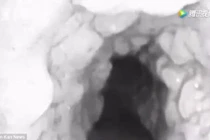 Kinh hoàng hàng loạt răng mọc trong cổ họng