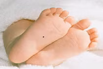 Sinh con có 3 nốt ruồi cực hiếm này giàu 3 họ, sướng 3 đời