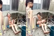 Mẹ trẻ khiến con bỏng 60% vì điều đơn giản dễ mắc này...