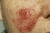 6 biểu hiện bất thường trên da cảnh báo bệnh nguy hiểm