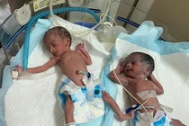 Ly kỳ chuyện cụ bà 74 tuổi... sinh đôi hai bé gái