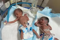 Ly kỳ chuyện cụ bà 74 tuổi... sinh đôi hai bé gái