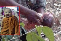 Cậu bé bị chôn sống, đâm 14 nhát dao, sống sót kỳ diệu giờ ra sao?