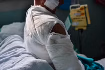 "Dị nhân" môi mọc trên ngực và đây là sự thật xót xa