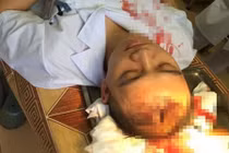 Bộ Y tế yêu cầu xử lý nghiêm đối tượng hành hung bác sỹ