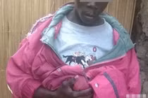 Chàng trai với “cậu nhỏ” quá khổ không ngờ và lý do đau lòng