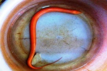 Huế: Hàng trăm người đổ xô xem lươn lạ cực hiếm, cực bổ 