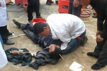 Chuyện lạ hôm nay: Kỳ tích, bị thanh thép xuyên qua đầu vẫn sống