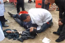 Chuyện lạ hôm nay: Kỳ tích, bị thanh thép xuyên qua đầu vẫn sống