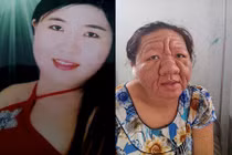 Tọa đàm gặp gỡ cô gái 29 tuổi biến thành bà lão 70 