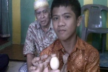 Sự thật về cậu bé biết đẻ trứng tại Indonesia