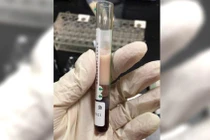 Ống máu màu cà phê sữa và sự thật hãi hùng về thứ quen...