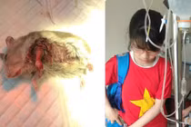 Xúc động 2 cô bé lớp 7 ôm chú chuột bị thương tới phòng khám