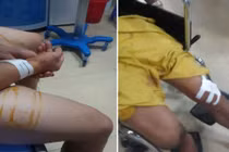 9X đâm chết người trong đám cưới vì bị quay clip 