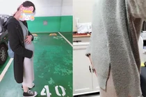 Cô gái “mang bầu” và sự thực lạ khiến mọi người choáng váng