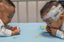 Cha mẹ đau lòng "bốc thăm" chọn cứu sống một trong hai con sinh đôi