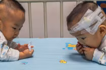 Cha mẹ đau lòng "bốc thăm" chọn cứu sống một trong hai con sinh đôi