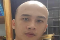 Bí ẩn về thanh niên đầu trọc 