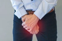 Người đàn ông khốn khổ, ngủ dậy mới biết "súng gãy" từ bao giờ