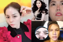 Đâu chỉ Lệ Quyên, nhiều sao Việt gặp họa vì nâng mũi