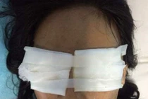 Mẹ chồng tạt axít vào mặt con dâu chết tại nhà riêng