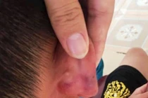 Nghệ An: Nghi vấn giáo viên tiểu học bạo hành dã man con riêng của chồng